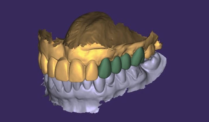 z5484127590869_a1f1e6ece6197e0eed6f6f88112ff5e8-1-640x516