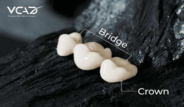 DENTAL-CROWNS-BRIDGES