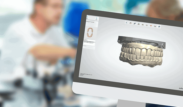 Dental CAD design companies
