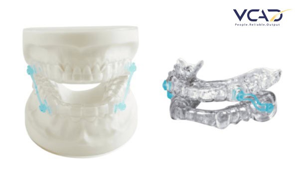 Anti-snoring device