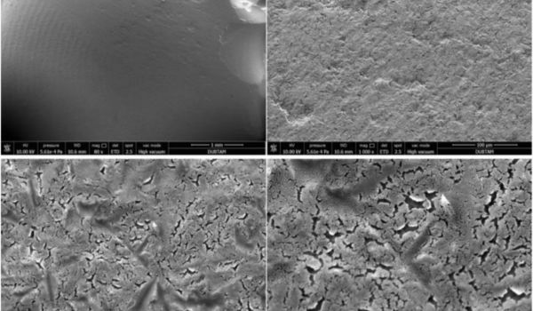 Effects of surface treatment methods on the phase changes in zirconia
