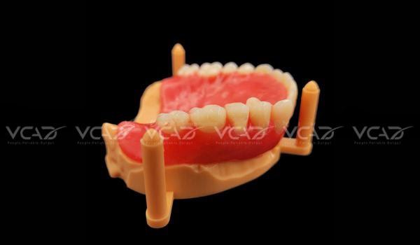 Upper Denture