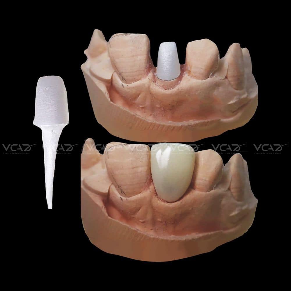 POST AND CORE