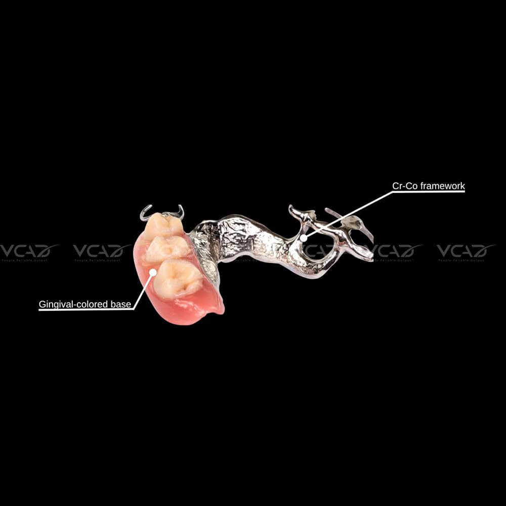 METAL PARTIAL DENTURE