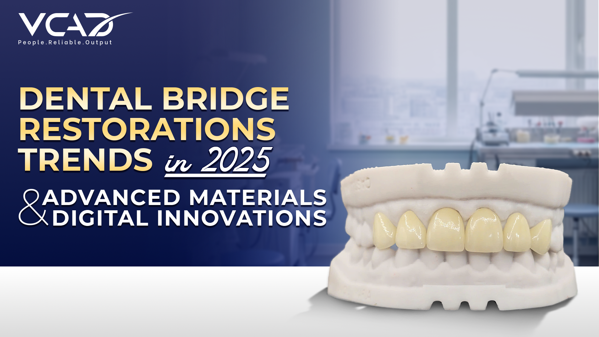Dental Bridge Restorations Trends in 2025: Advanced Materials & Digital ...